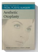 Aesthetic Otoplasty (Thomas Procedures in Facial Plastic Surgery)