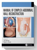 Manual of Complex Abdominal Wall Reconstruction